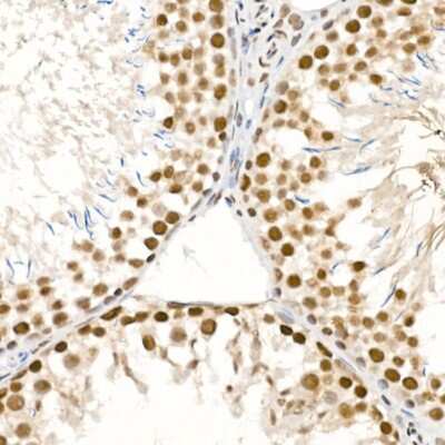 Immunohistochemistry-Paraffin: ATR [p Ser428] Antibody - Azide and BSA Free [NBP3-05447]